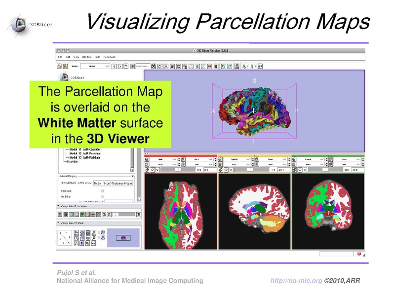 File:FreeSurferCourse Slicer3.6 SoniaPujol.pdf