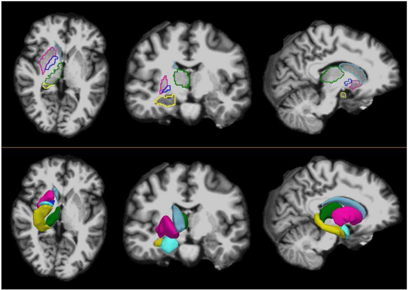 File:Jovicich-Neuroimage2009-fig1.png