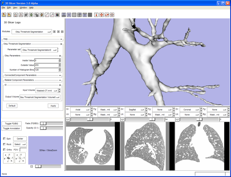 File:Slicer3-lung.png