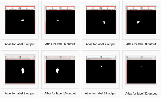 Modules:AtlasCreator - Slicer Wiki