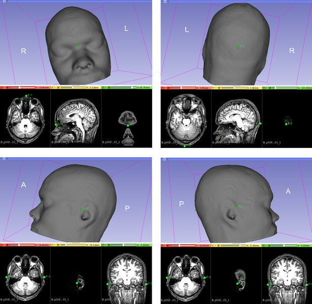 File:4 landmarks.png