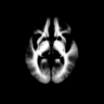 EMSegmenter MRI-Human-Brain WM 420x420.png