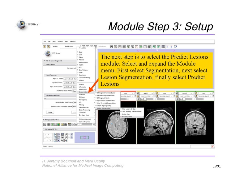 File:Slicer3Training WhiteMatterLesions v2.3.pdf