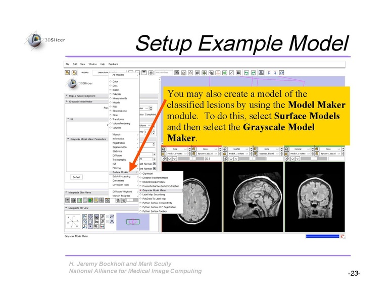 File:Slicer3Training WhiteMatterLesions v2.3.pdf