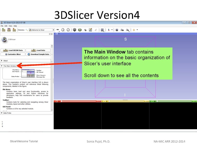 File:3DDataLoadingandVisualization Slicer43 SoniaPujol.pdf