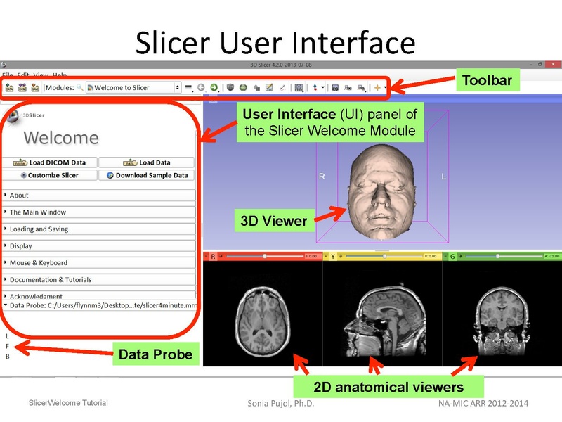 File:3DDataLoadingandVisualization Slicer43 SoniaPujol.pdf