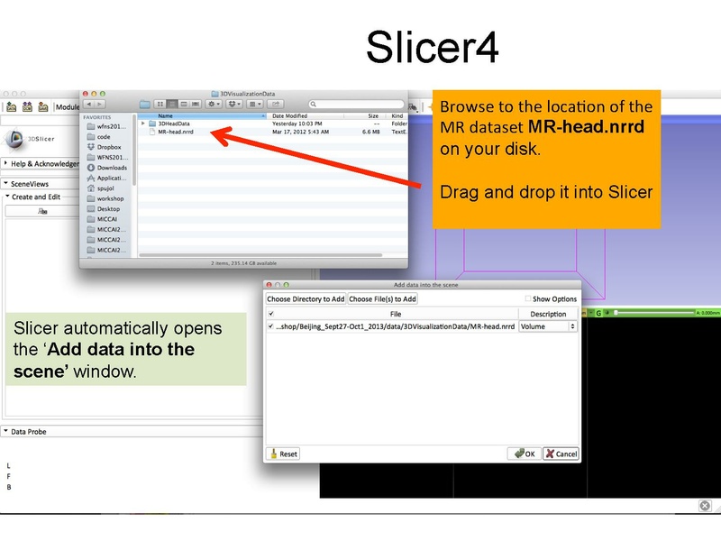 File:3DDataLoadingandVisualization Slicer43 SoniaPujol.pdf