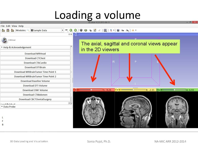 File:3DDataLoadingandVisualization Slicer43 SoniaPujol.pdf