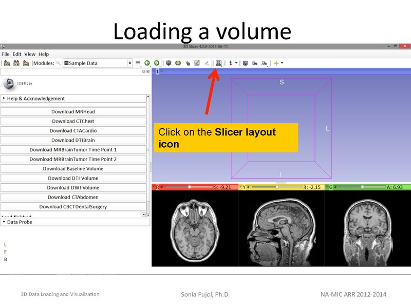 File:3DDataLoadingandVisualization Slicer43 SoniaPujol.pdf