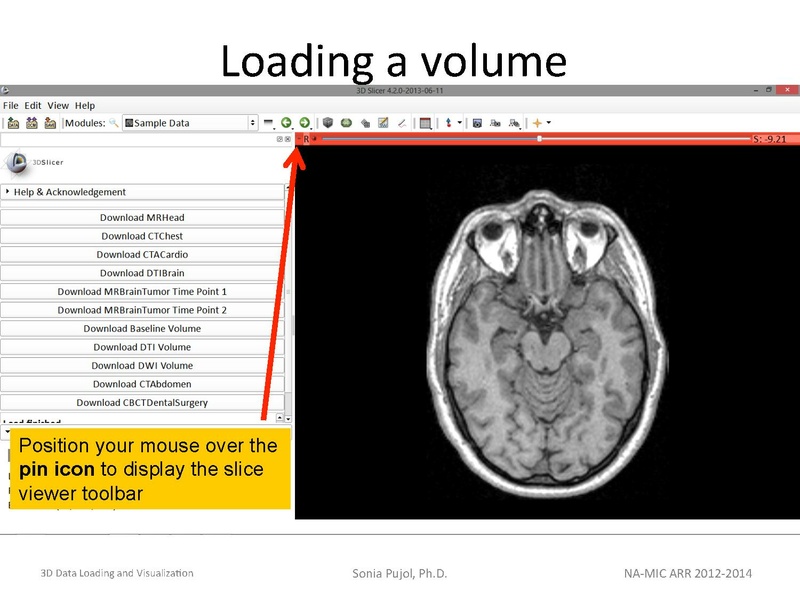 File:3DDataLoadingandVisualization Slicer43 SoniaPujol.pdf