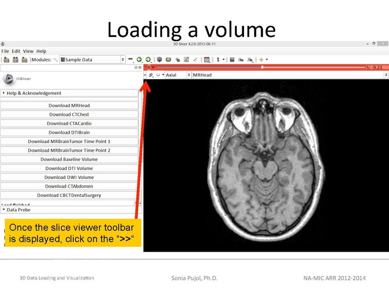 File:3DDataLoadingandVisualization Slicer43 SoniaPujol.pdf