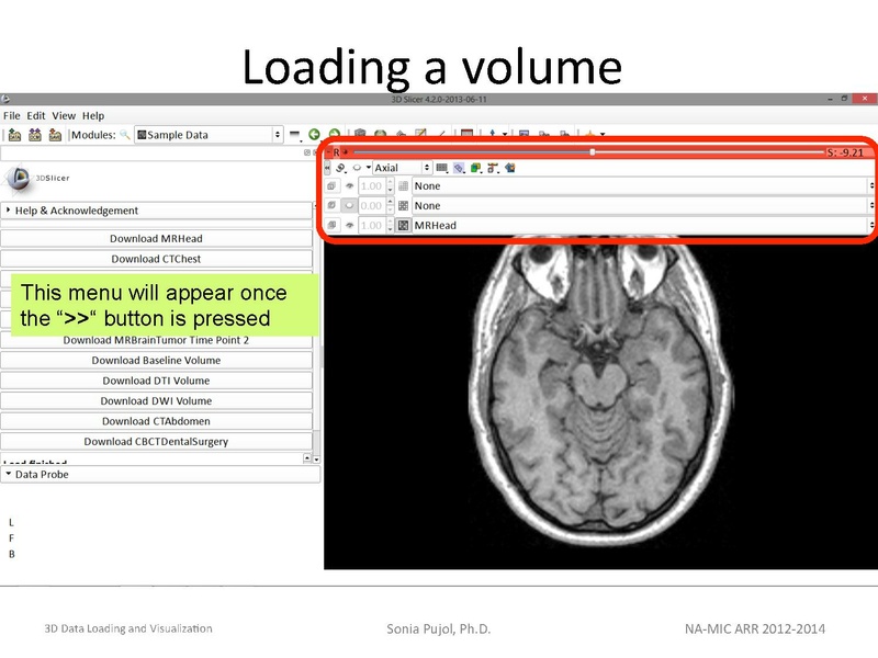 File:3DDataLoadingandVisualization Slicer43 SoniaPujol.pdf