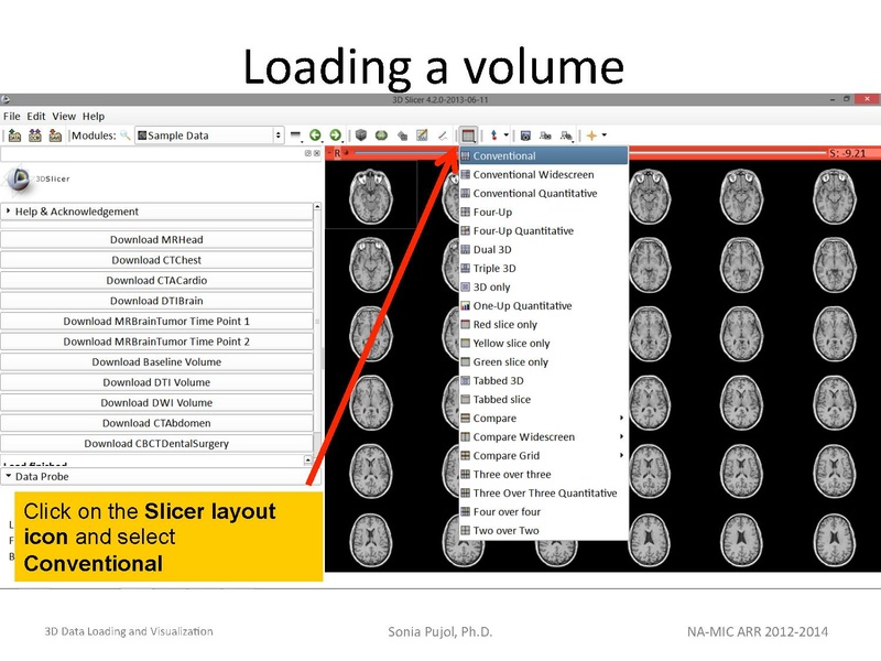 File:3DDataLoadingandVisualization Slicer43 SoniaPujol.pdf