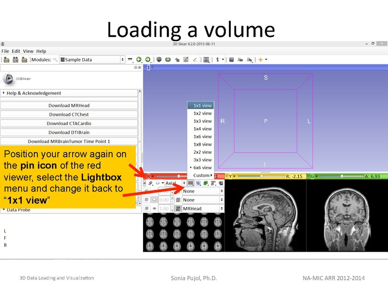 File:3DDataLoadingandVisualization Slicer43 SoniaPujol.pdf