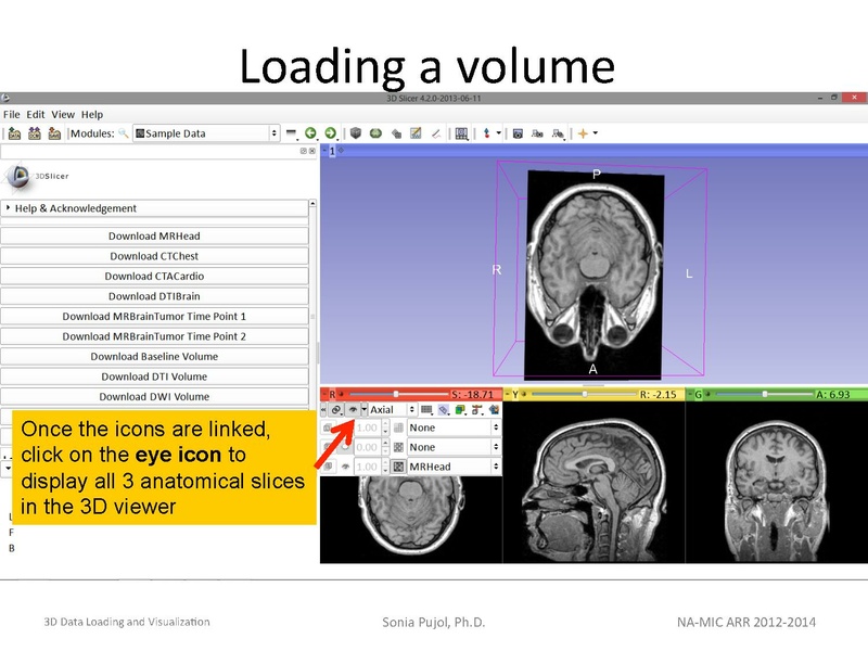 File:3DDataLoadingandVisualization Slicer43 SoniaPujol.pdf