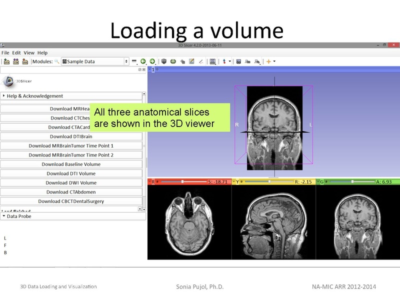 File:3DDataLoadingandVisualization Slicer43 SoniaPujol.pdf