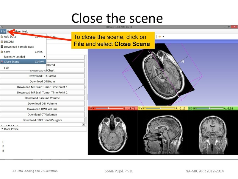 File:3DDataLoadingandVisualization Slicer43 SoniaPujol.pdf