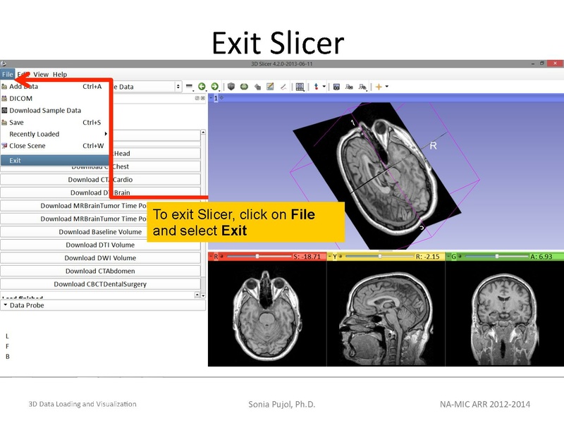 File:3DDataLoadingandVisualization Slicer43 SoniaPujol.pdf