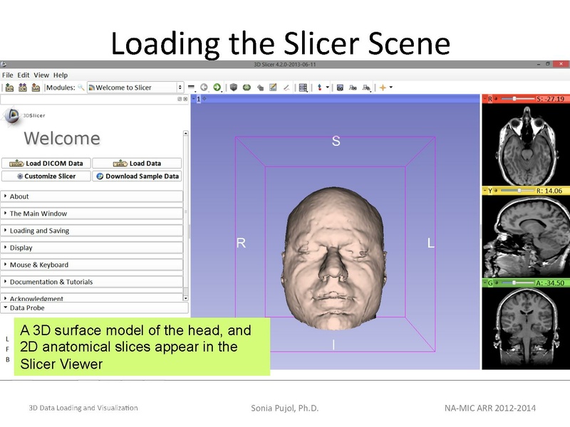 File:3DDataLoadingandVisualization Slicer43 SoniaPujol.pdf