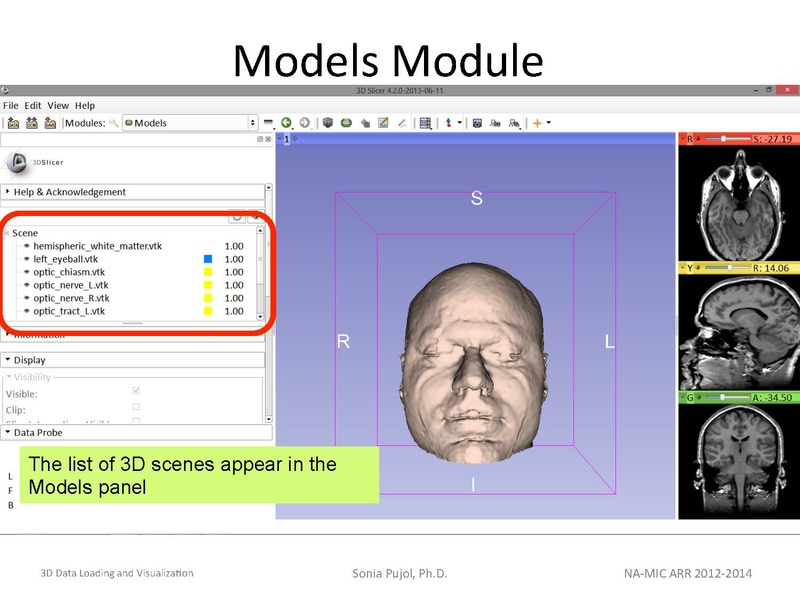 File:3DDataLoadingandVisualization Slicer43 SoniaPujol.pdf