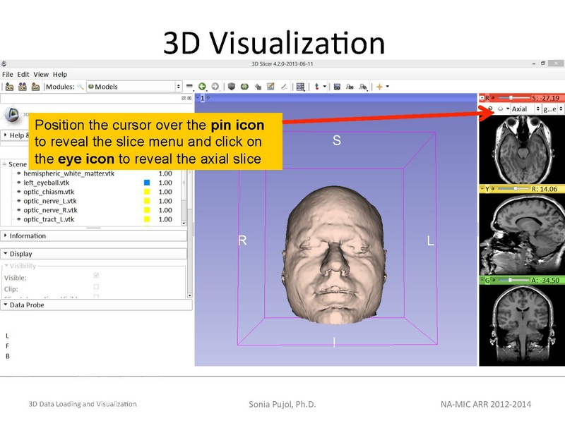 File:3DDataLoadingandVisualization Slicer43 SoniaPujol.pdf