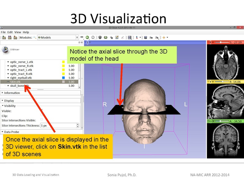 File:3DDataLoadingandVisualization Slicer43 SoniaPujol.pdf