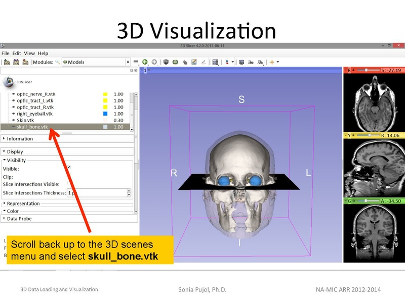File:3DDataLoadingandVisualization Slicer43 SoniaPujol.pdf