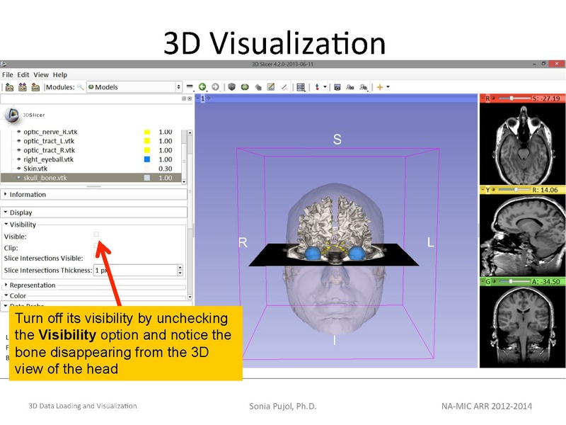 File:3DDataLoadingandVisualization Slicer43 SoniaPujol.pdf