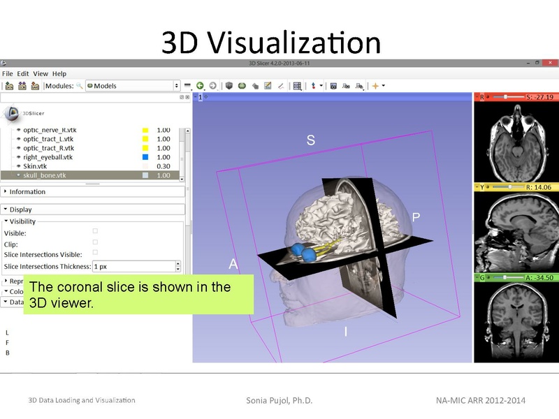 File:3DDataLoadingandVisualization Slicer43 SoniaPujol.pdf