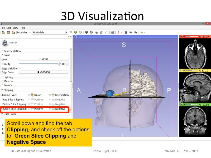 File:3DDataLoadingandVisualization Slicer43 SoniaPujol.pdf