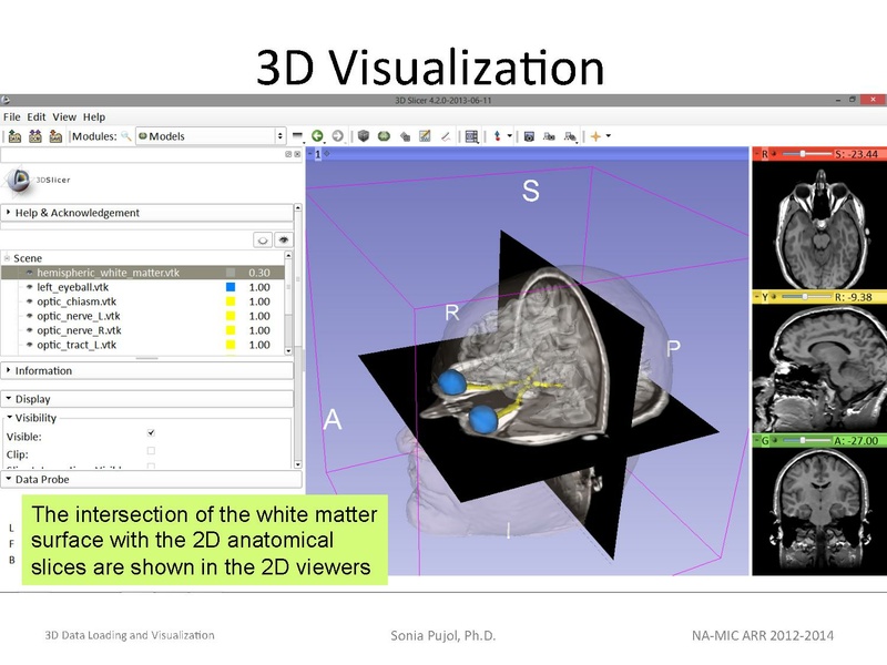 File:3DDataLoadingandVisualization Slicer43 SoniaPujol.pdf
