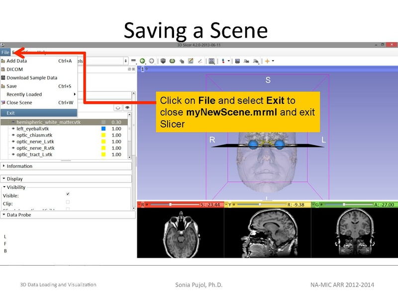 File:3DDataLoadingandVisualization Slicer43 SoniaPujol.pdf