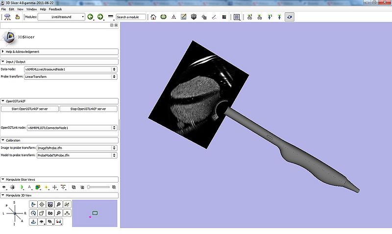 File:LiveUltrasoundModule-Slicer4 2.jpg